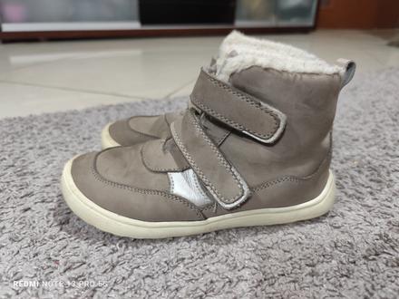 Protetika bf čižmičky, protetika,33