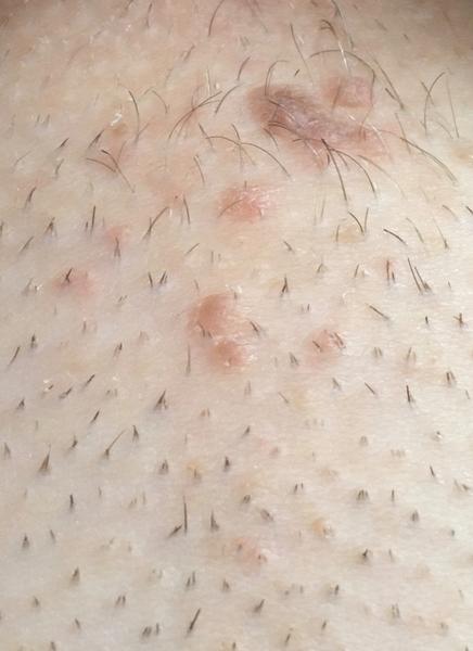 Sú to nové znamienka?