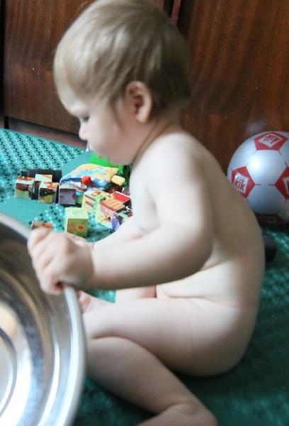 Ako liečiť 14 mesačné hypotonické dieťatko so zväčšenou kyfózou?