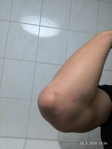 Je to opäť svrab alebo niečo iné?