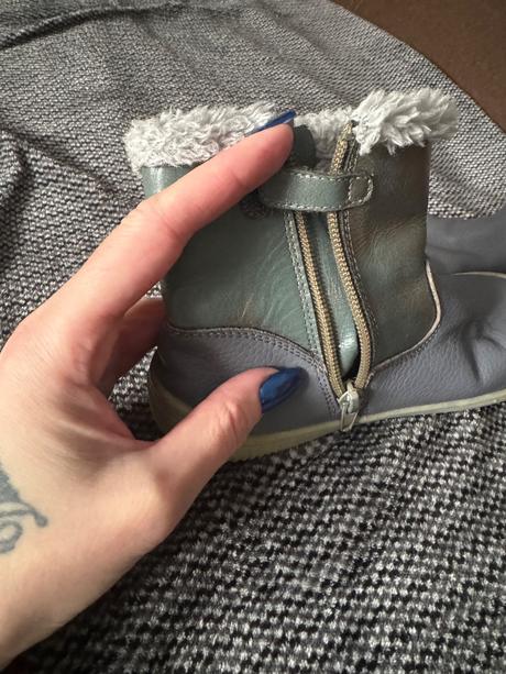 Protetika topanky, protetika,31