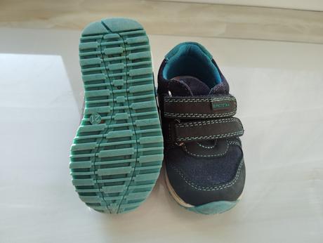 Protetika redly tyrkys, protetika,21