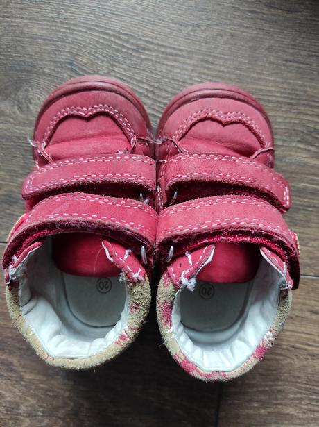 Topánky protetika 20, protetika,20