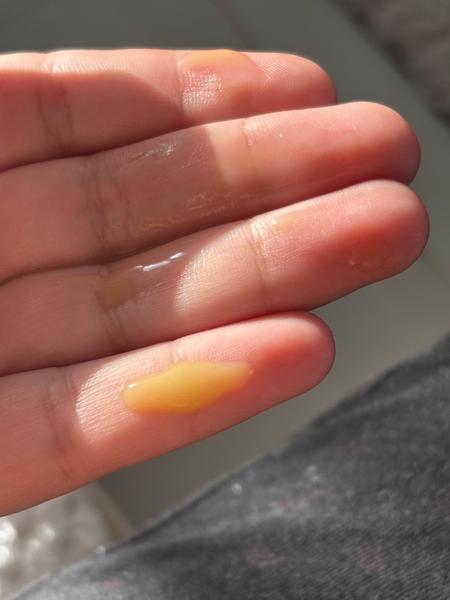 Je táto farba materského mlieka normálna?