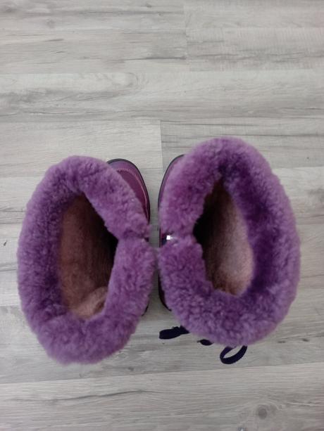 Protetika čižmy, protetika,33