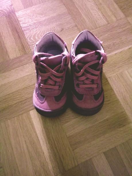 Topánocky protetika, protetika,20