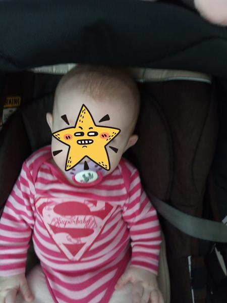 Hlavička - je to normálny vývin lebky?