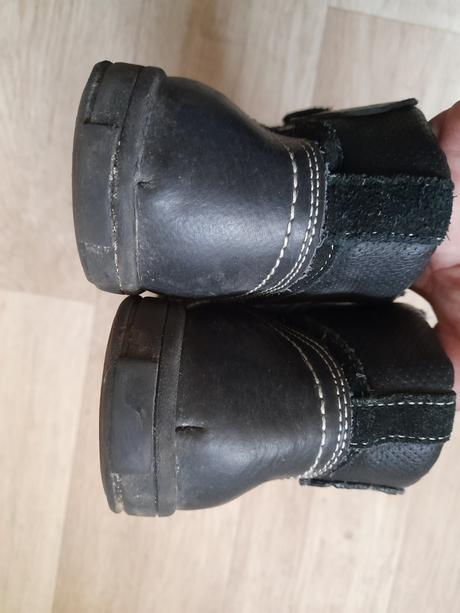 Topanky, protetika,32