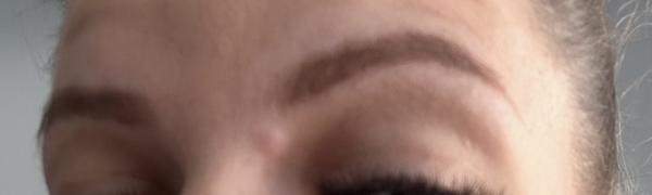 Akú hrčku mám pri nose?