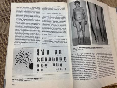 Vnútorné lekárstvo 2 dionýz dieška kolektív autor,