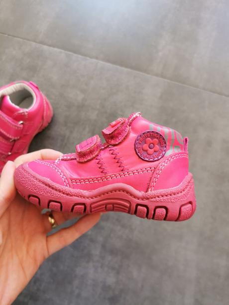 Topánky protetika, protetika,19