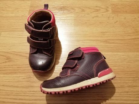 Topanky protetika, protetika,23