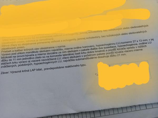 Aké vyšetrenia potrebujete pri zväčšených uzlinách?