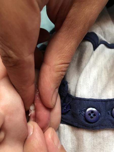 Problém s ďasienkami