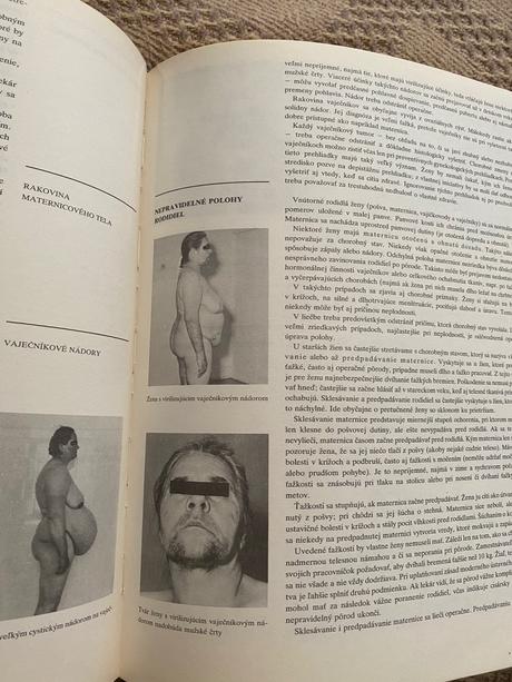 Obrovská stará retro kniha zdravoveda osveta 1980, 
