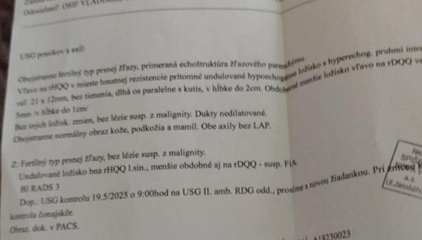 Mám sa obávať hrčky v prsníku?