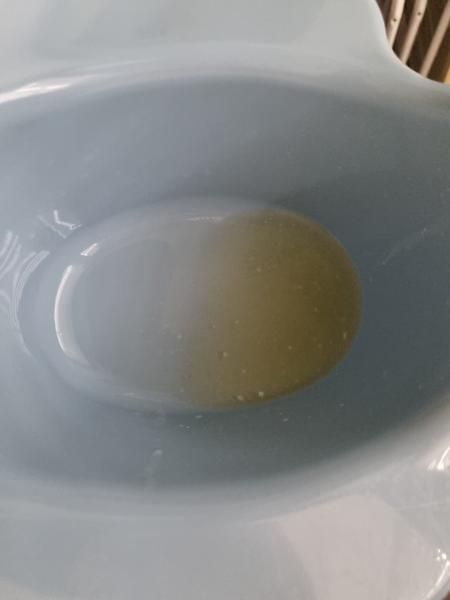 Syn má teplotu a zmeny v moči: Kedy navštíviť pohotovosť?