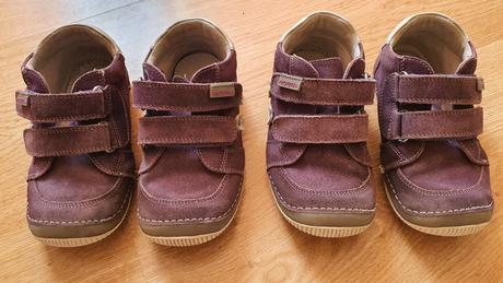 Protetika topanky, protetika,25