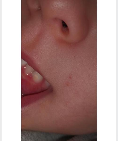 Ako zachrániť zúbky trojročného syna?