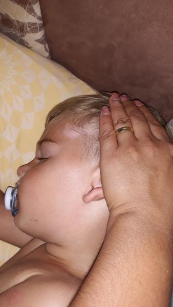 Ako liečiť znamienka, v ktorých chýba pigment?