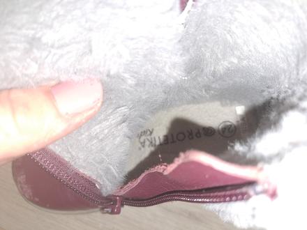 Zimne topanocky, protetika,24