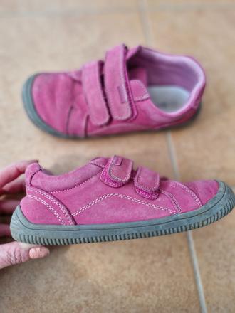 Bardfoot protika, protetika,33