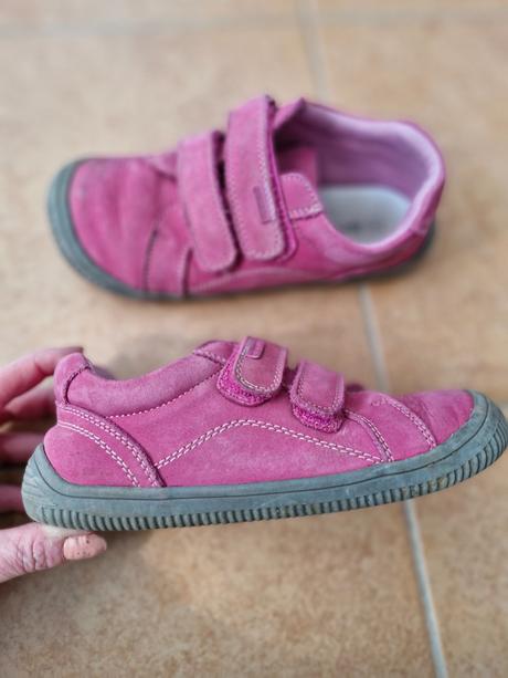 Bardfoot protika, protetika,33