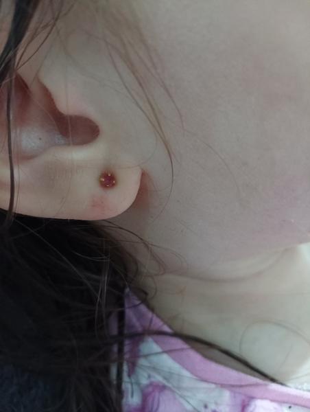 Čo to má dcérka na uchu?