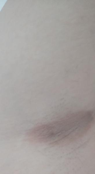 Čo sa mi to vyhodilo na obidvoch pazuchách?