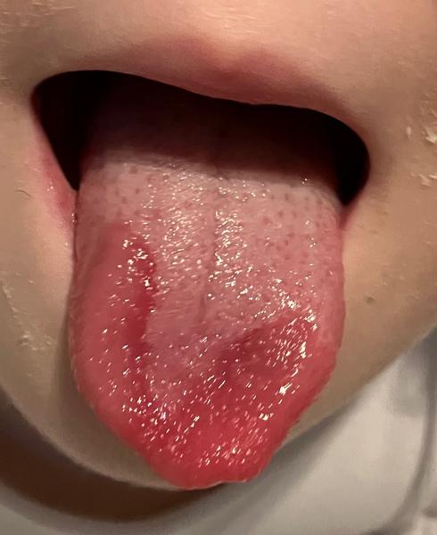 Prečo má dcéra fľakatý jazyk?