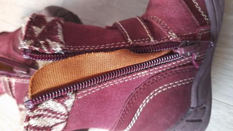 Čižmičky, protetika,20