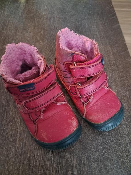 Prechodne topanky, protetika,22