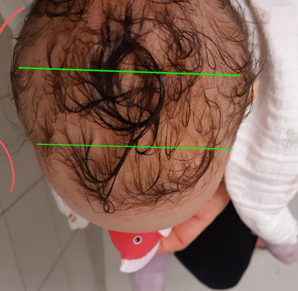 Je toto normálny tvar hlavičky?