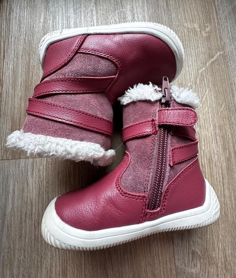 Čižmy protetika, protetika,21