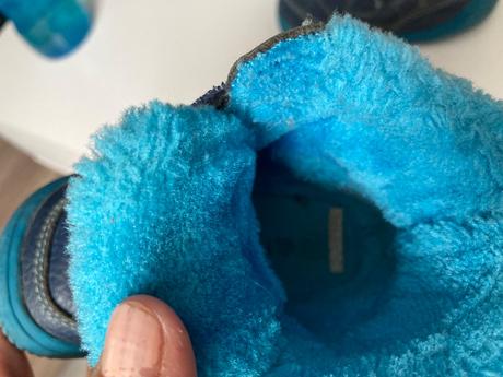 Prechodné topánky protetika, protetika,20