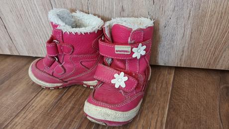 Zimne topánky protetika, protetika,19