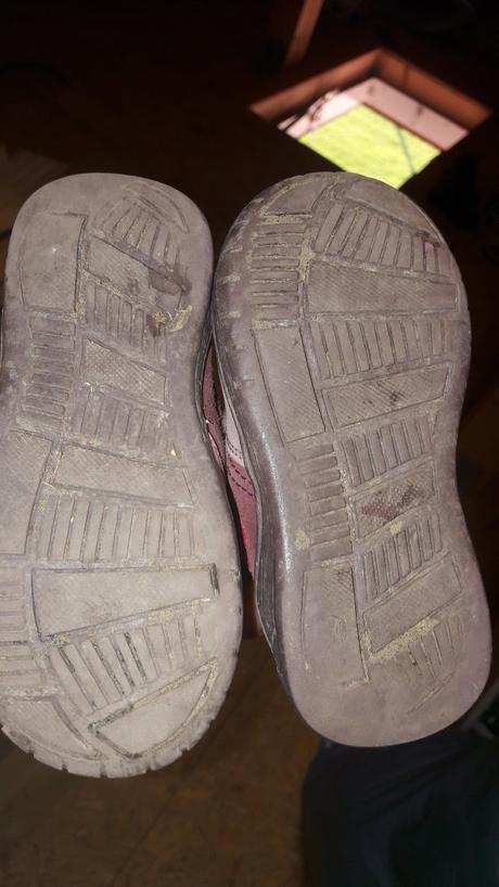 Malo nosene topanky, protetika,24