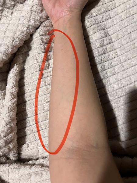 Nevysvetliteľná bolesť ruky