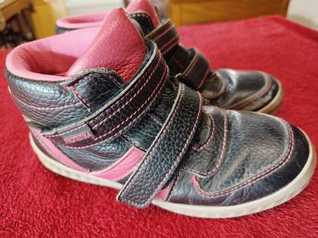 Prechodné topánky, protetika,32