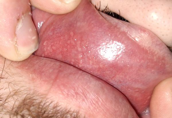 Čo to má manžel na pere?