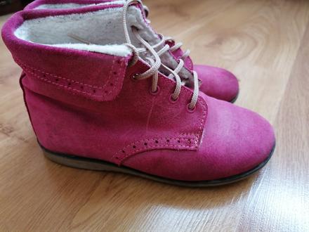 Kotnicky, protetika,30