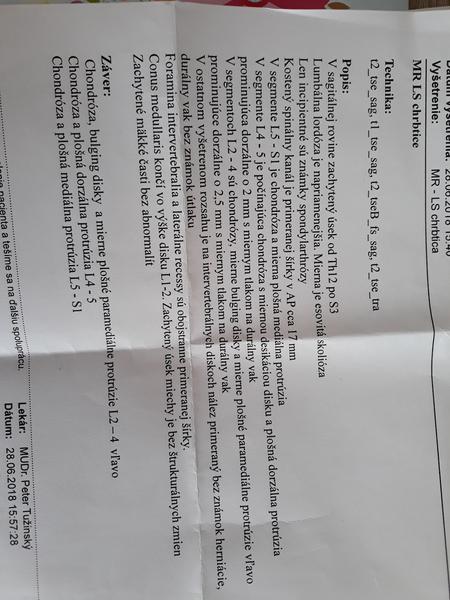 Ako sa lieči seknutie v krížoch?