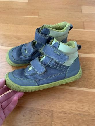 Zimne topanocky protetika, protetika,32