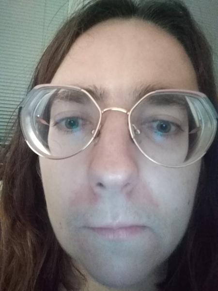 Hľadám kožnú lekárku vo Zvolene alebo v Banskej Bystrici