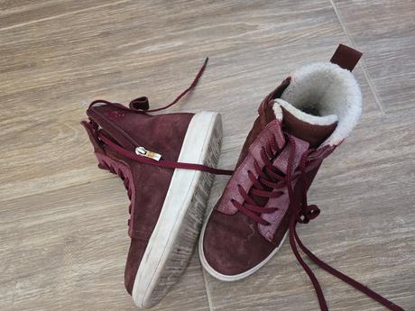 Prechodné topánky č.33, protetika,33