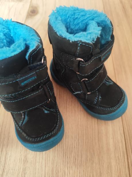 Čižmičky protetika, protetika,19