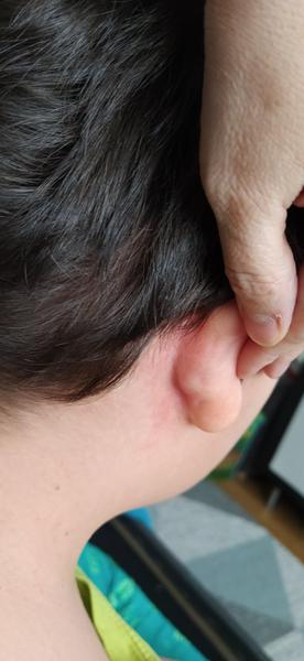 Ide u syna o alergiu alebo o sprievodnú reakciu vírusu?