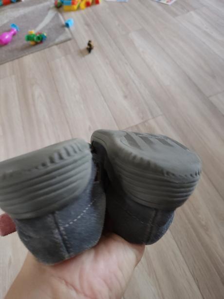 Sandálky barefoot protetika, protetika,33