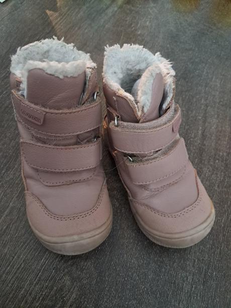 Cizmy protetika, protetika,22