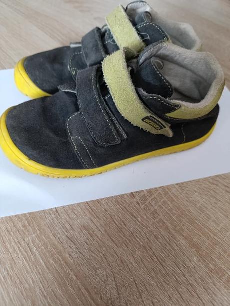 Barefoot protetika, protetika,31